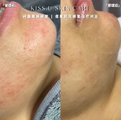 -KISS U 国际美学