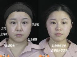 点击看大图 -Yestar重庆艺星医疗美容医院