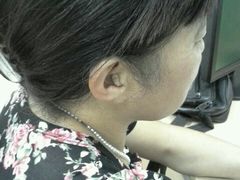 -惠耳听力助听器(奉贤南桥店)