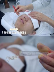 -悟空祛痘·诺奖技术专业店