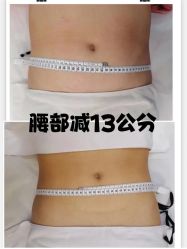 -Lily纤美·科技减脂中心