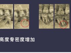 -同步齿科·数字化正畸种植口腔中心(珠海店)