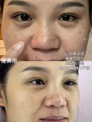 -Yestar重庆艺星医疗美容医院