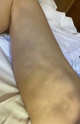 -西安现代妇产医院医疗美容