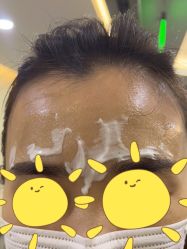 体验前-北京炫美医疗美容