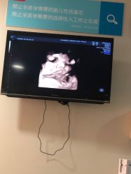 -杭州贝瑞斯美华妇儿医院·早孕·产检·儿科