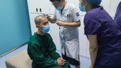 -大麦微针植发全国连锁