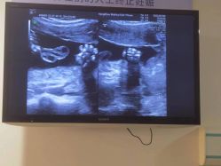 -杭州贝瑞斯美华妇儿医院·早孕·产检·儿科