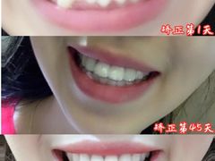 -团圆口腔·种植中心(锦江院区)