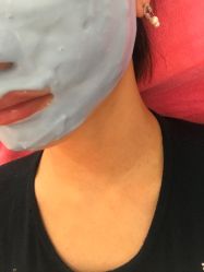 -成都苗方清颜专业祛痘