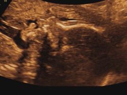 -武汉百佳妇产医院