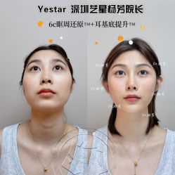 -深圳艺星医疗美容医院