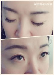 睫毛嫁接-光SPA科技美肤