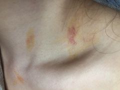 -盲行盲人推拿·采耳·艾灸(滨江宝龙店)