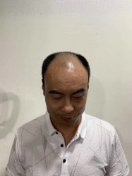 -发饰美男士增发补发假发定制店