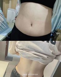 -Fundi张玉珊修身堂·indiba·BTL科技瘦身