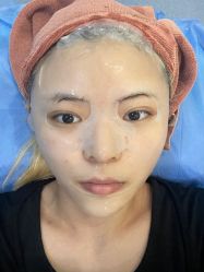 -广州健丽·去眼袋医疗美容机构