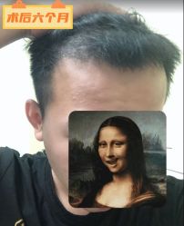 -雍禾植发全国连锁