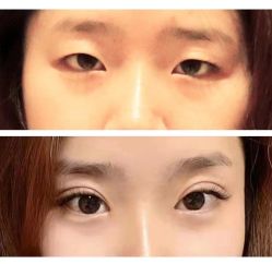 -Yestar 嘉兴艺星医疗美容医院