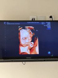 -杭州贝瑞斯美华妇儿医院·早孕·产检·儿科