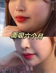 -上海漾颜医疗美容