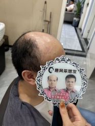 -唐风采假发补发定制