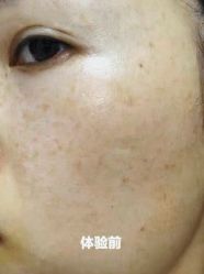 -伊丽莎白医疗美容