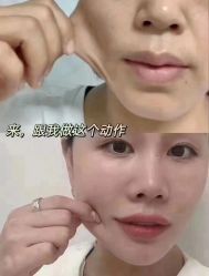 -MLP美丽派·问题肌疗愈中心