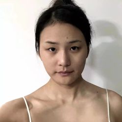 -天津健丽·去眼袋医疗美容机构