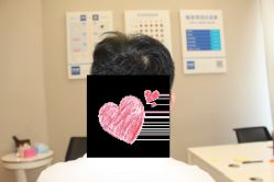 -大麦微针植发丨全国连锁