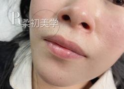-RC半永久纹眉纹发际线