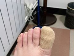 -世龙世家灰指甲鸡眼脚气甲沟炎跖疣护理(通州店)