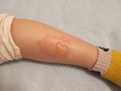 -重庆西南医院(西南院区)