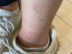 -五七小李子油焖大虾(总店)