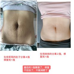-梦斯绮私密催乳修复中心