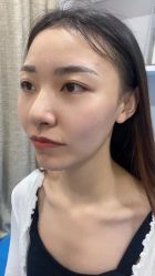 体验后-重庆联合丽格第五医疗美容医院