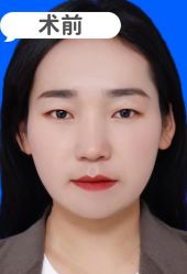 -素美医疗美容·西南眼鼻整形·修复基地