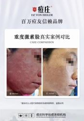 -痘庄科学祛痘国际连锁