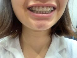 -贵阳美莱医疗美容整形医院