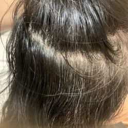 -诗碧曼养发