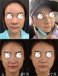 -北京米扬丽格医疗美容·联合丽格鼻整形中心