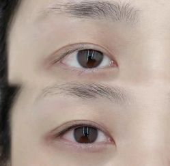 -美愈美肤MEIYU SKIN