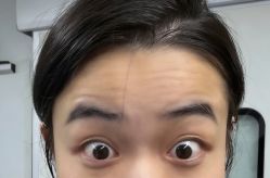 -天津健丽·去眼袋医疗美容机构