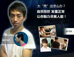 -髻尚坊增发补发织发假发定制