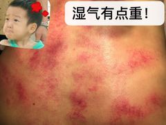 -韩蒸·东方艾·理疗艾灸养生馆