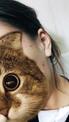 -北京美痣堂古方祛痣斑疣瘊