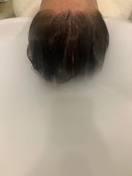 -丝域养发馆