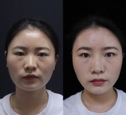 -长沙雅美医疗美容医院