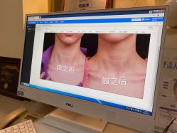 -美莱医学美容医院