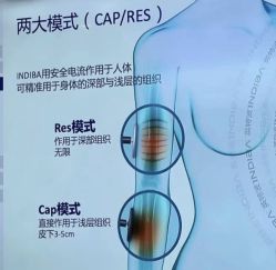 -半岛故事·法儿曼抗衰·indiba中心